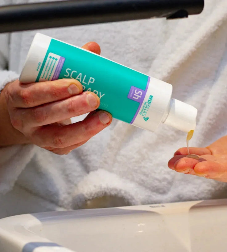 Seborrhoisches Ekzem Kopfhaut Behandlung - Hairgivers