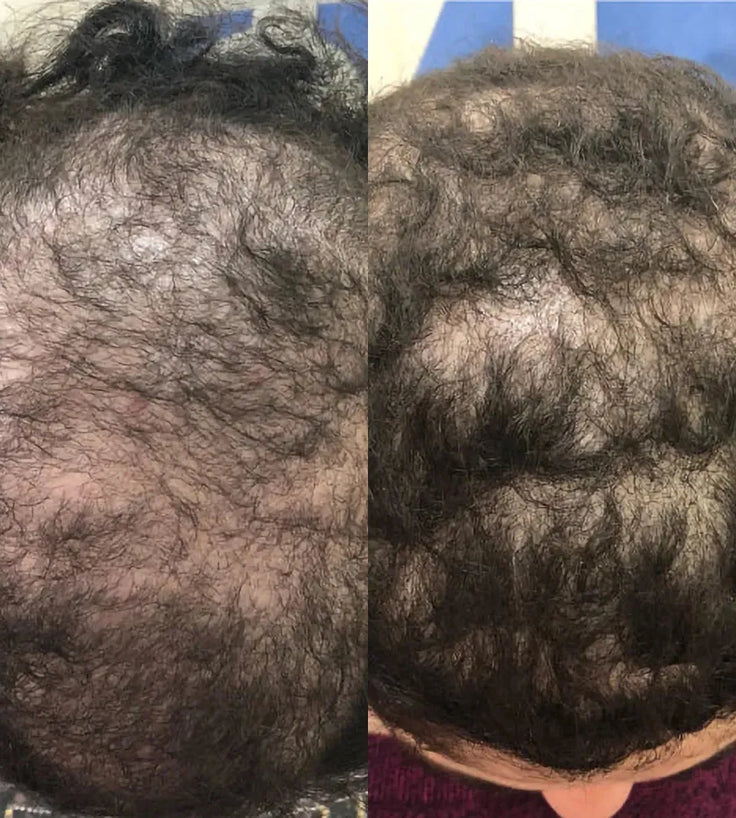 Spectral.CSF Haarserum - Hairgivers