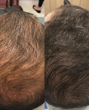 Spectral DNC-N (Nanoxidil) Haarserum Spectral DNC-N (Nanoxidil) Haarserum - Hairgivers