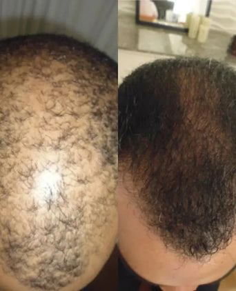 Spectral DNC-N (Nanoxidil) Haarserum Spectral DNC-N (Nanoxidil) Haarserum - Hairgivers