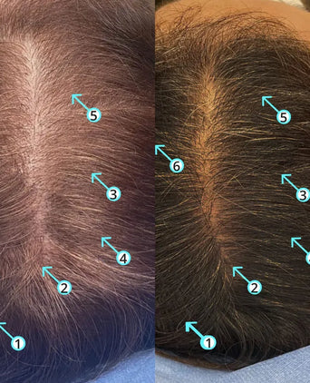 Spectral.DNC-S Haarserum Spectral.DNC-S Haarserum - Hairgivers