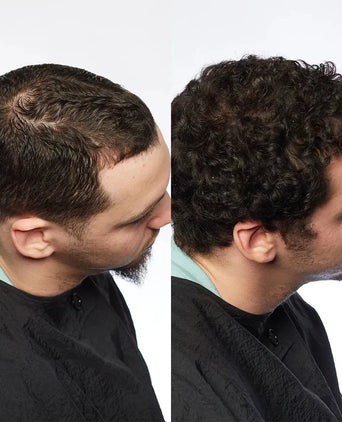 Theradome LH80 PRO Laserhelm Theradome LH80 PRO Laserhelm - Hairgivers