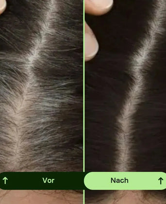 Toppik Hair Thickener Farbspray Toppik Hair Thickener Farbspray - Hairgivers