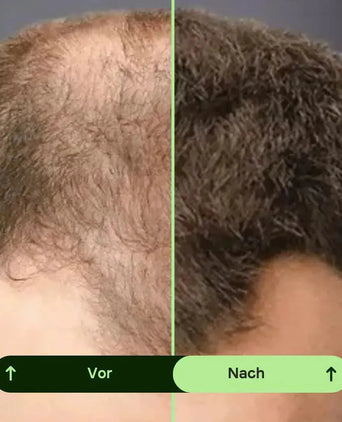 Toppik Hair Thickener Farbspray Toppik Hair Thickener Farbspray - Hairgivers