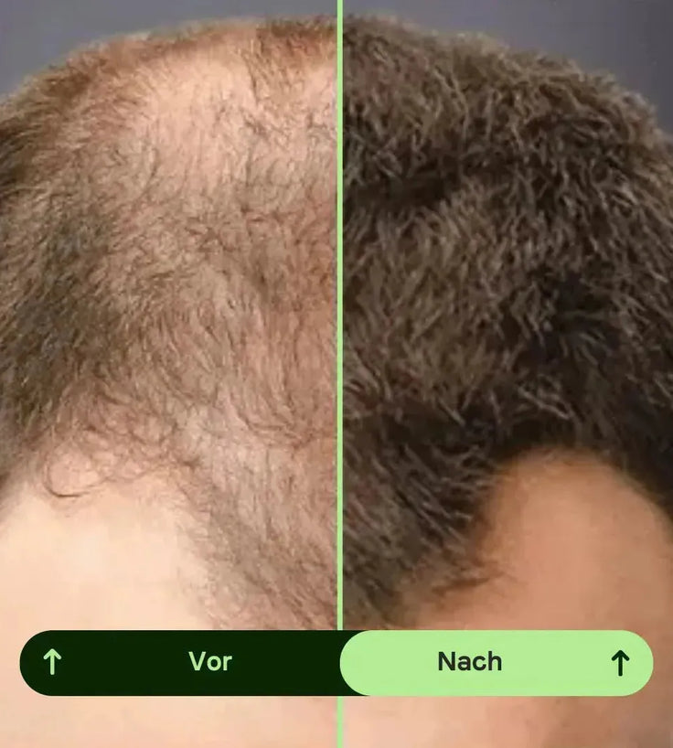 Toppik Hair Thickener Farbspray - Hairgivers