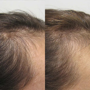 Viviscal Haarwachstums-Tabletten für Frauen (1 Monat) Viviscal Haarwachstums-Tabletten für Frauen (1 Monat) - Hairgivers
