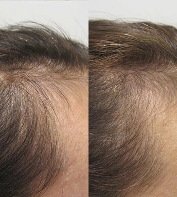 Viviscal Haarwachstums-Tabletten für Frauen (1 Monat) Viviscal Haarwachstums-Tabletten für Frauen (1 Monat) - Hairgivers