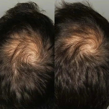 Viviscal Tabletten für Männer (1 Monat) Viviscal Tabletten für Männer (1 Monat)