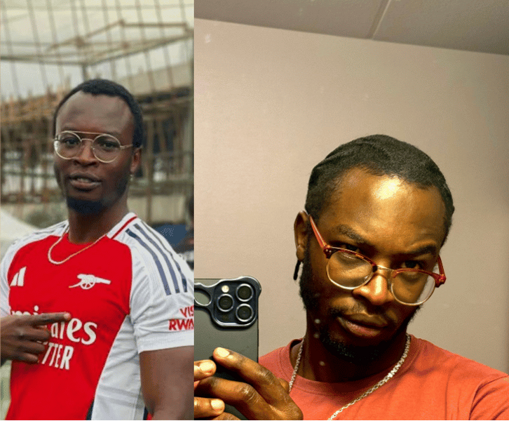 Cliftons Weg aus dem Haarausfall – echte Ergebnisse dank Minoxidil