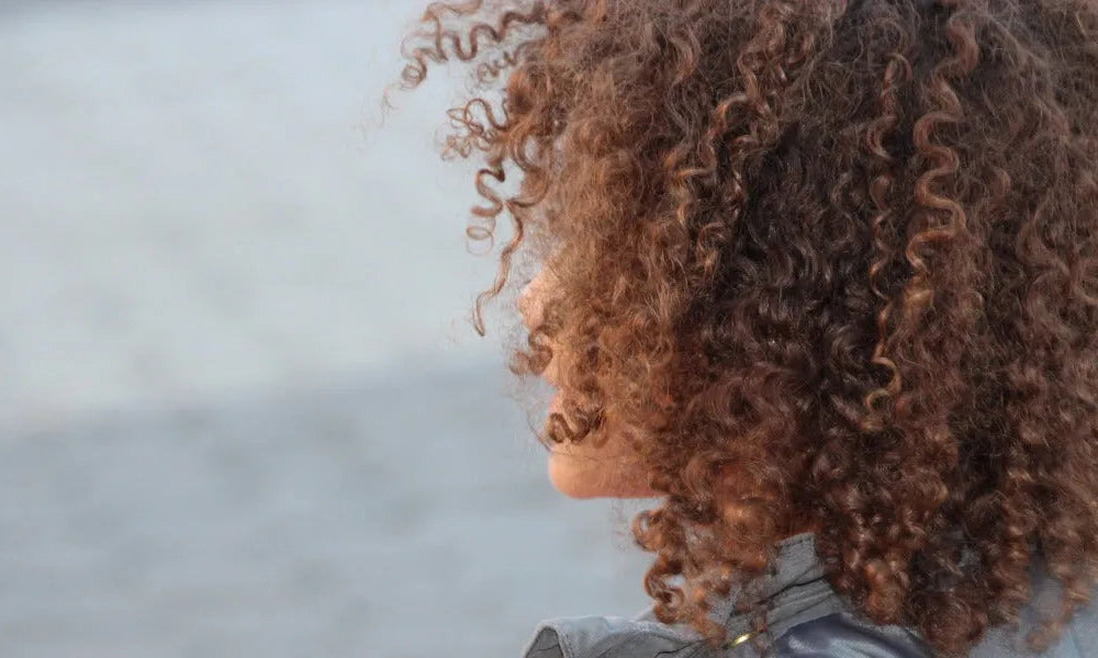 Tinea capitis (Ringelflechte der Kopfhaut)