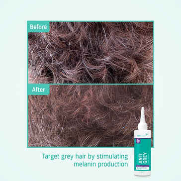 Neofollics Anti-Grau Haarserum - Hairgivers