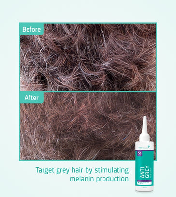 Neofollics Anti-Grau Haarserum - Hairgivers