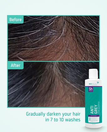 Neofollics Anti-Grau Shampoo