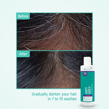 Neofollics Anti-Grau Shampoo