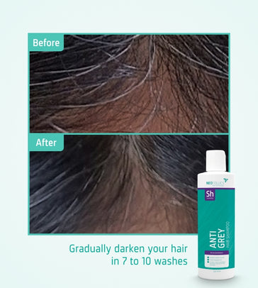 Neofollics Anti-Grau Shampoo