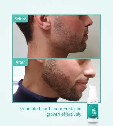 Neofollics Bartserum (7% Neoxyl) - Hairgivers