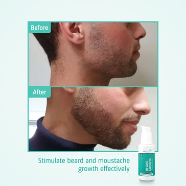Neofollics Bartserum 3-Pack (7% Neoxyl) - Hairgivers