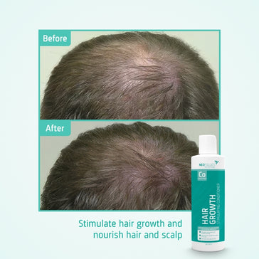 Neofollics Conditioner - Hairgivers