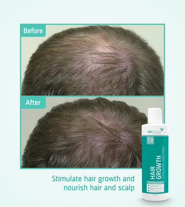Neofollics Conditioner - Hairgivers