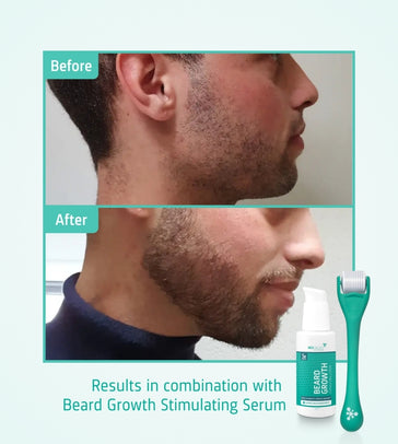 4x Neofollics Bartserum + kostenlose Bartroller - Hairgivers