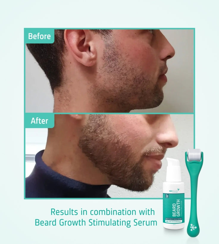 4x Neofollics Bartserum + kostenlose Bartroller