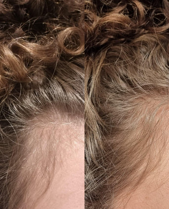 Golden Effect Intense Growth Hair Serum