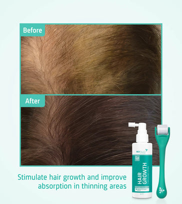 Neofollics Haarwuchs Kit - Hairgivers