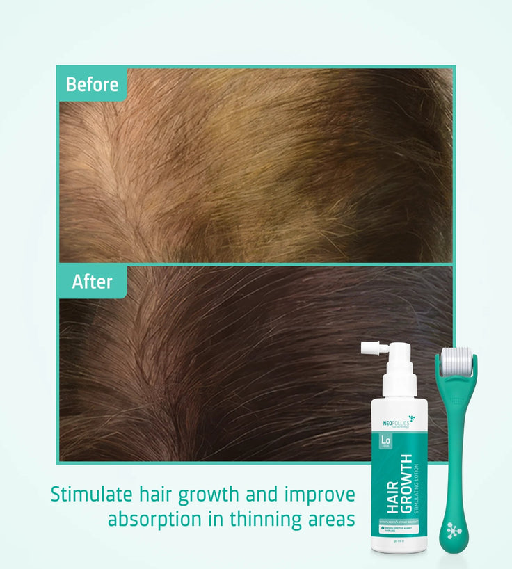 Neofollics Haarwuchs Serum + Roller