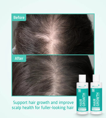 Neofollics Shampoo + Conditioner Starter-Kit - Hairgivers