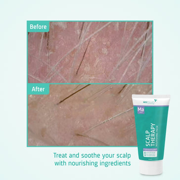 Neofollics Pflegende Maske - Hairgivers