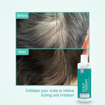 Neofollics Peeling Shampoo - Hairgivers