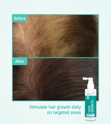 Neofollics Serum gegen Haarausfall (7% Neoxyl) - Hairgivers