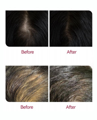 Beaver Anti-Haarausfall Shampoo + Serum + Applikator