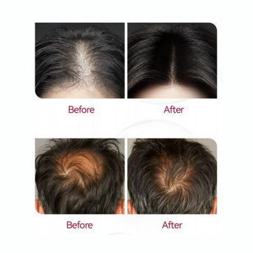 Beaver Anti-Haarausfall Shampoo + Serum + Applikator