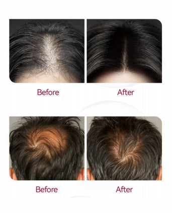 Beaver Anti-Haarausfall Serum