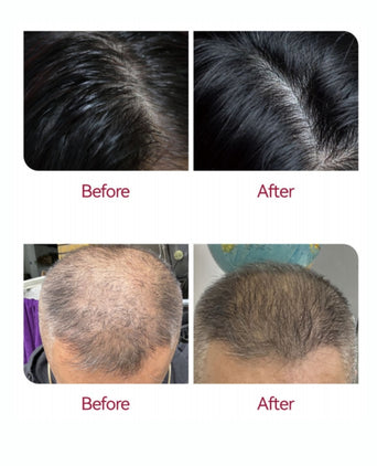 Beaver Anti-Haarausfall Serum