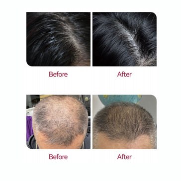 Beaver Anti-Haarausfall Serum