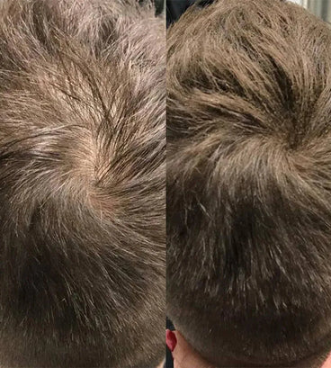 Beaver Keratin Schütthaar - Blond (12 gr)