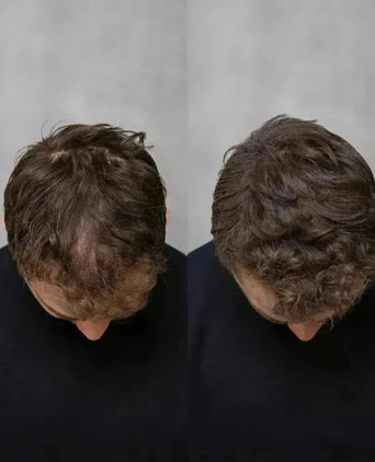 Keratain Pomade + Keratain Streuhaar - Hairgivers