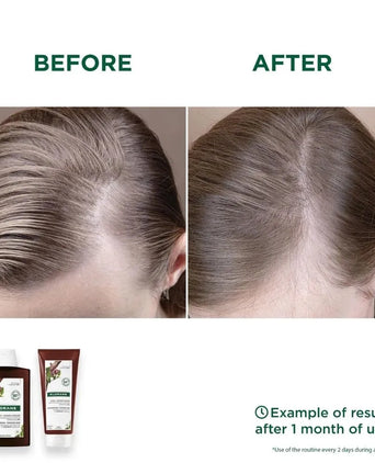 Klorane Anti-Haarausfall Shampoo Chinin/Edelweiss (200 ml) - Hairgivers