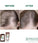 Klorane Anti-Haarausfall Shampoo Chinin/Edelweiss (200 ml) - Hairgivers