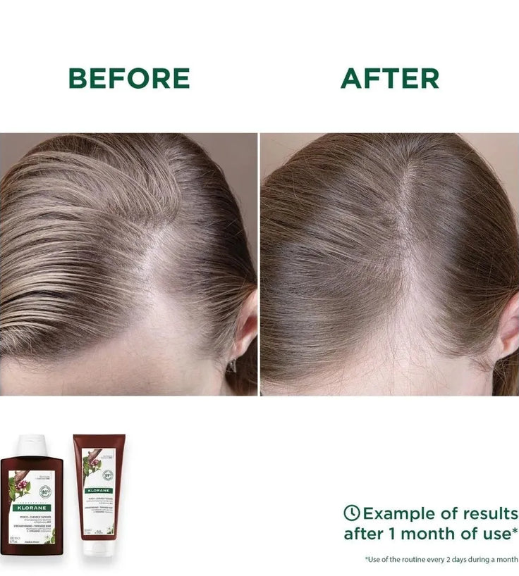 Klorane Anti-Haarausfall Shampoo Chinin/Edelweiss (200 ml) - Hairgivers
