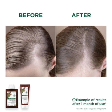 Klorane Anti-Haarausfall Shampoo + Conditioner - Hairgivers