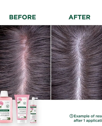 Klorane Shampoo Pfingstrose - empfindliche Kopfhaut (400 ml) - Hairgivers