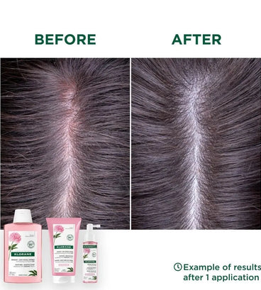 Klorane Shampoo Pfingstrose - empfindliche Kopfhaut (400 ml) - Hairgivers