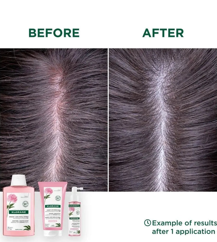 Klorane SOS Serum empfindliche Kopfhaut Pfingstrose (100 ml) - Hairgivers