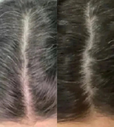 Neofollics Anti-Grau Haartabletten Neofollics Anti-Grau Haartabletten - Hairgivers