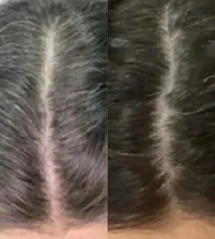 Neofollics Anti-Grau Haartabletten - Hairgivers