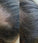 Panthrix Haarwuchs Aktivator 3-Pack (Redensyl) - Hairgivers