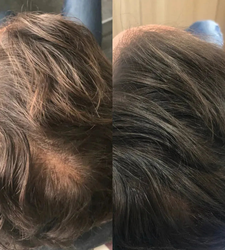 Revita Shampoo gegen Haarausfall (205 ml) - Hairgivers